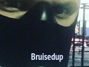 Bruisedup